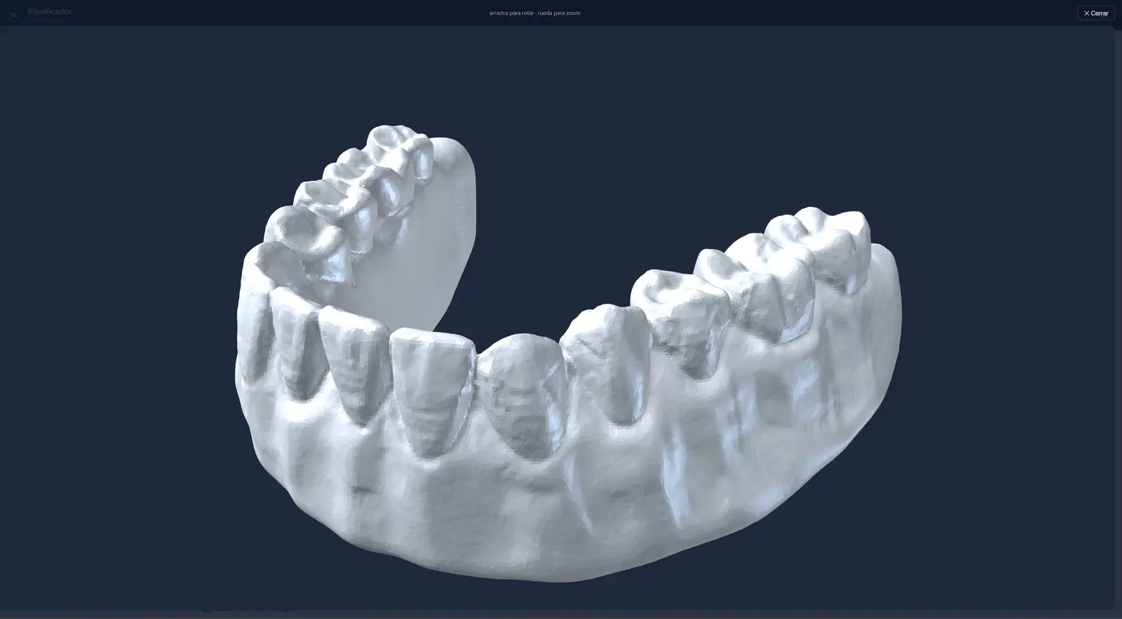 Visor 3D integrado: el escaneo de la clínica, en el trabajo